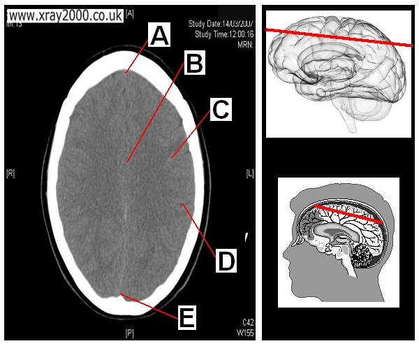 AXIAL SECTION 2.JPG